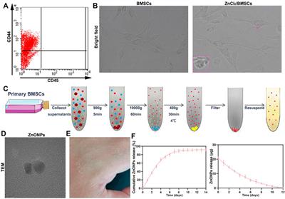 Bioengineered Zinc Oxide Nanoparticle-Loaded Hydrogel for Combinative Treatment of <mark class="highlighted">Spinal Cord Transection</mark>